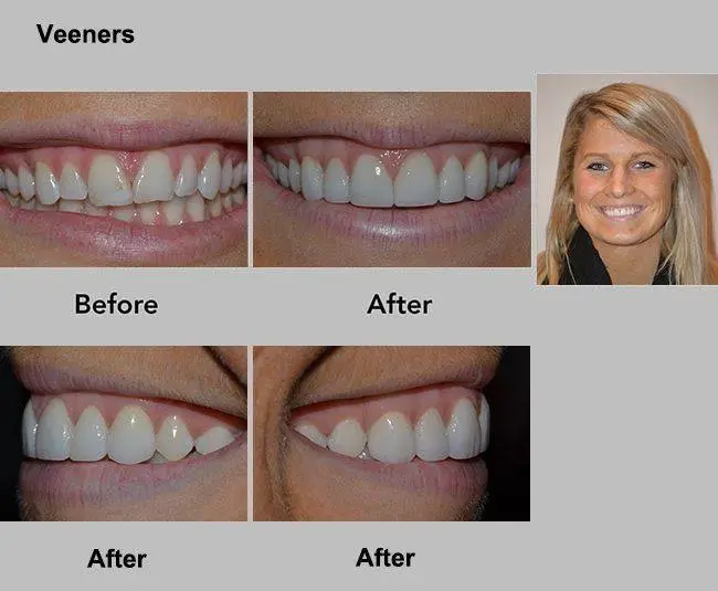 Art of Cosmetic Dentistry