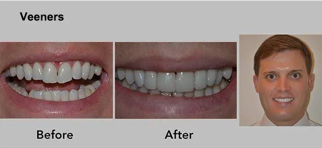 Art of Cosmetic Dentistry