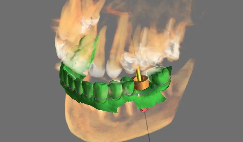 Providence Dental Spa