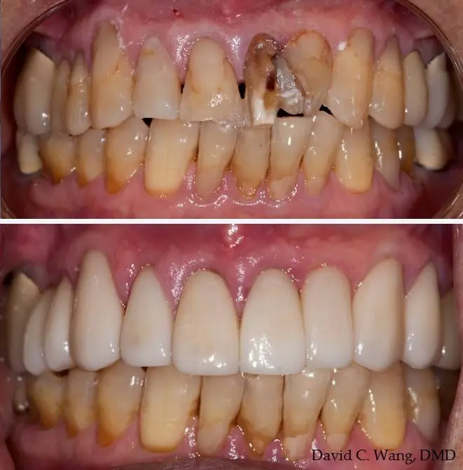 Providence Dental Spa