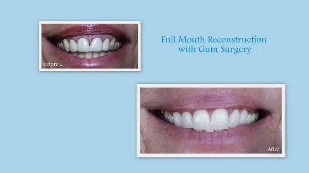 Thomas W. Kauffman, DDS, PC