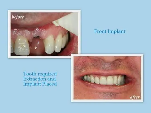 Thomas W. Kauffman, DDS, PC