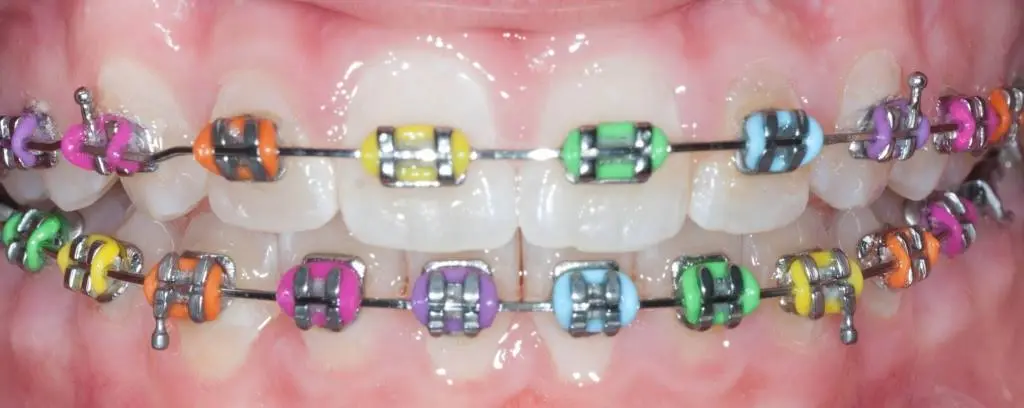 Puccio & Hussain Orthodontics
