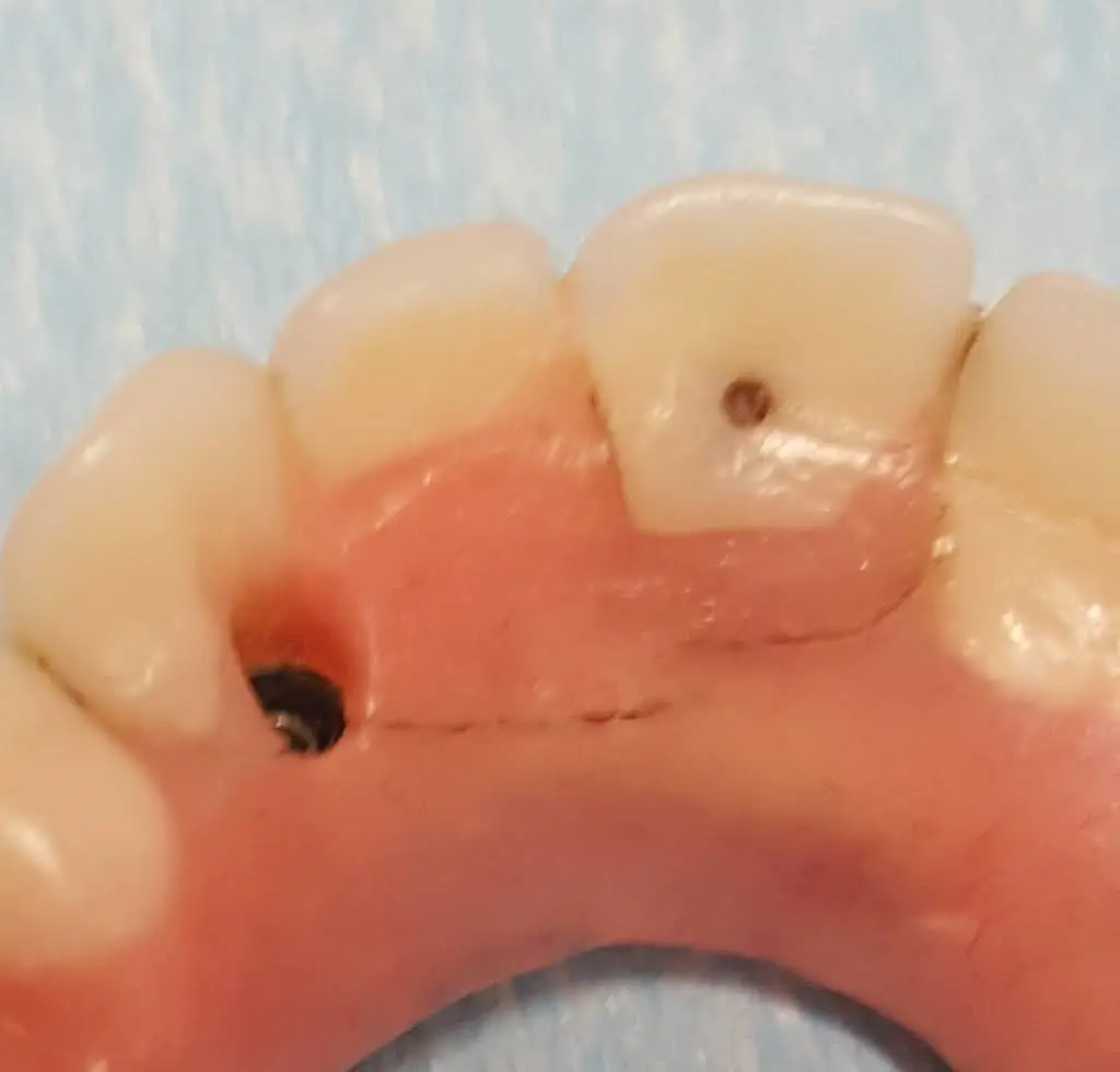 ClearChoice Dental Implant Center