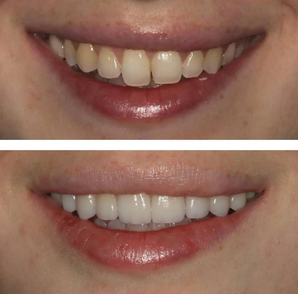 Decatur Family Dental