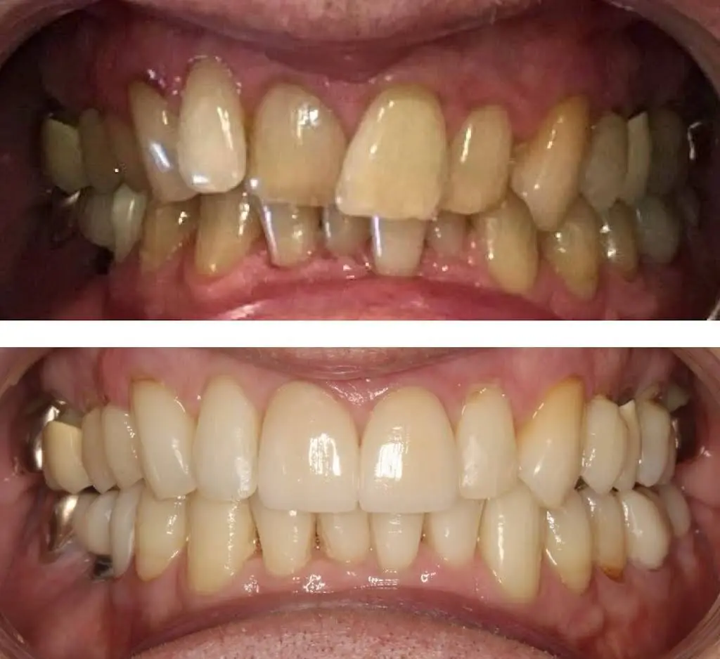 Decatur Family Dental