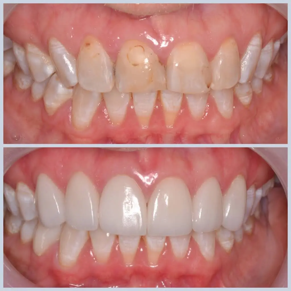 Smiles for Life Dental Care