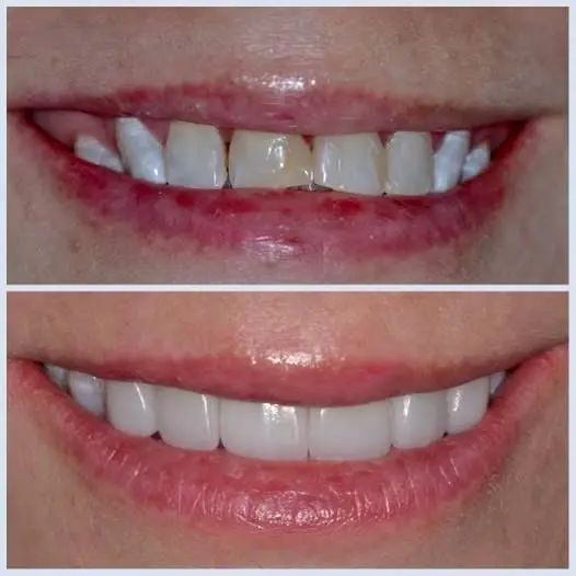 Smiles for Life Dental Care