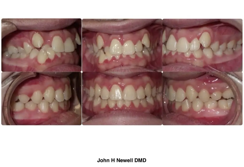 John H. Newell DMD, Orthodontist