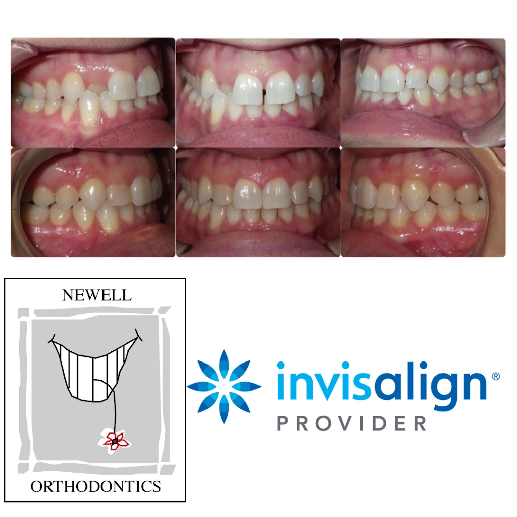 John H. Newell DMD, Orthodontist