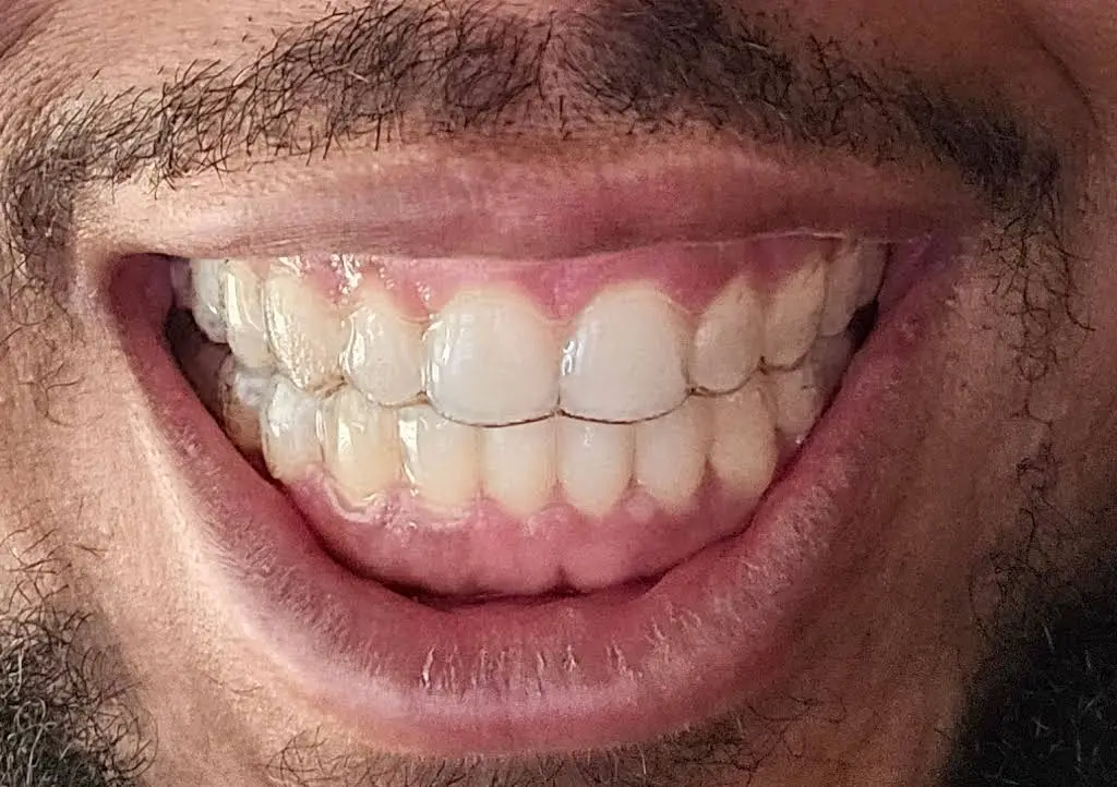 Lily Smile Center