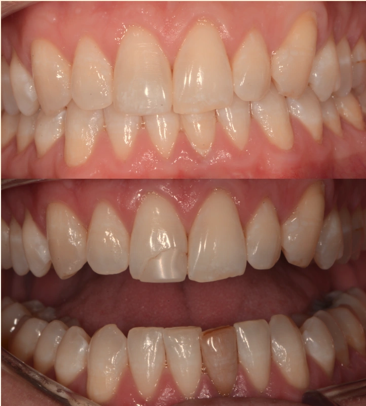 Saratoga Springs Family Dentistry
