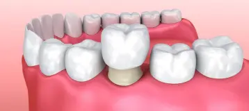 Family Dental Care of Marietta