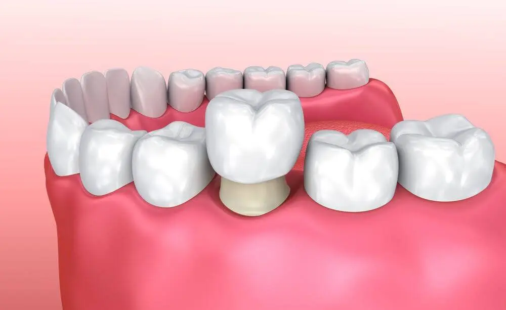Family Dental Care of Marietta