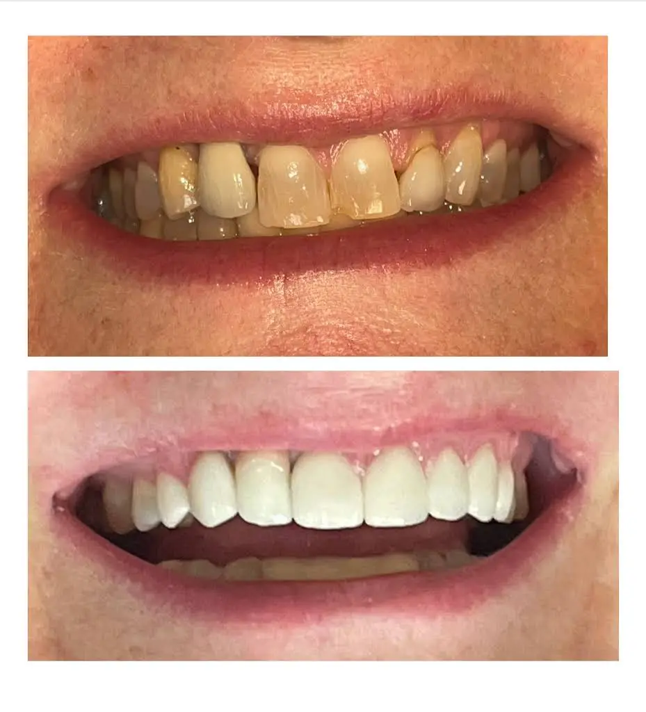East Cobb Premier Dental