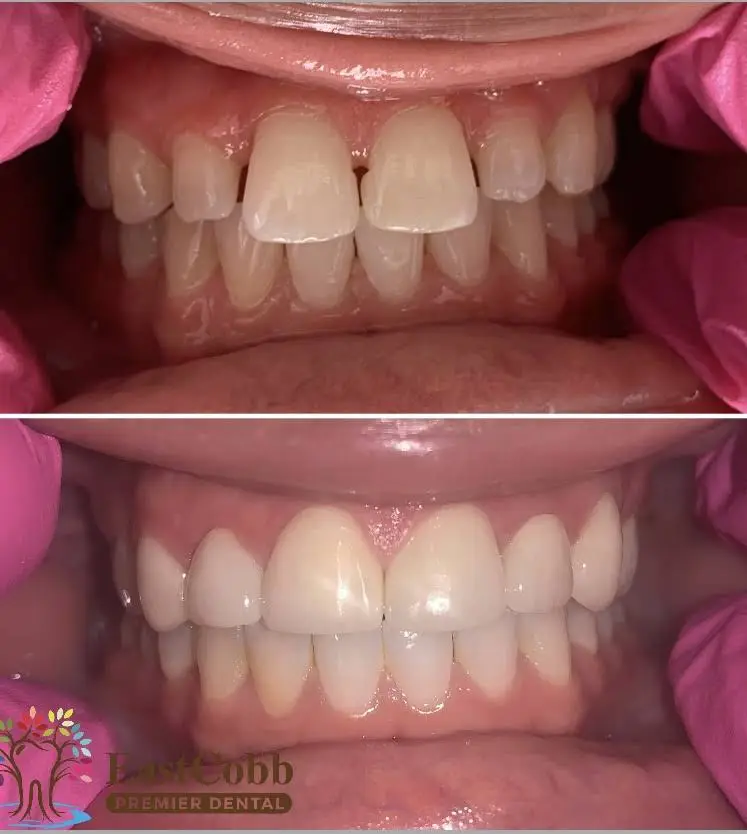 East Cobb Premier Dental