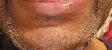 Nova Dental