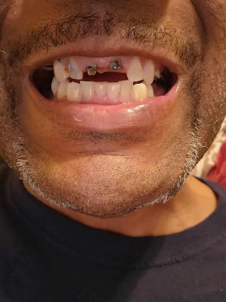 Nova Dental