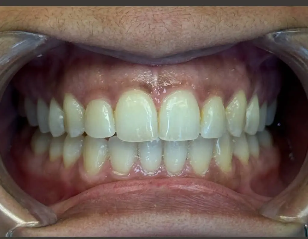 Shallowford Dental Studio of Roswell