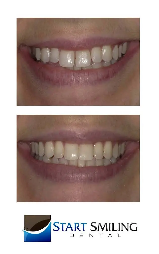 Start Smiling Dental