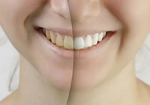 Saratoga Family Dentistry