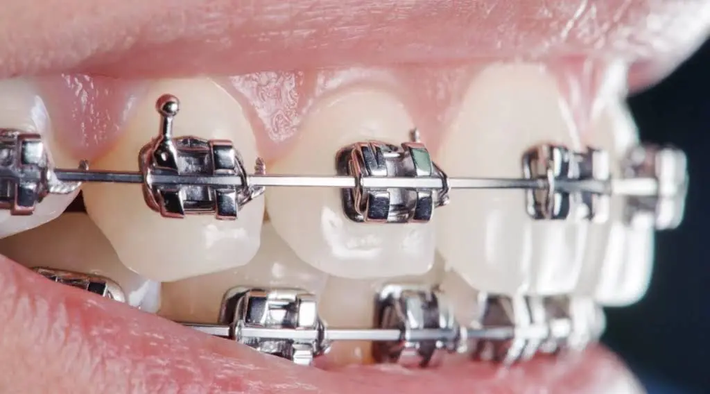 Quest Orthodontics