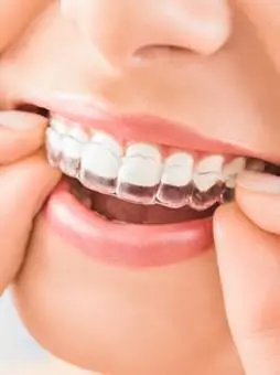 Inspire Dental of Roswell