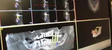 Periodontics and Dental Implants of Roswell