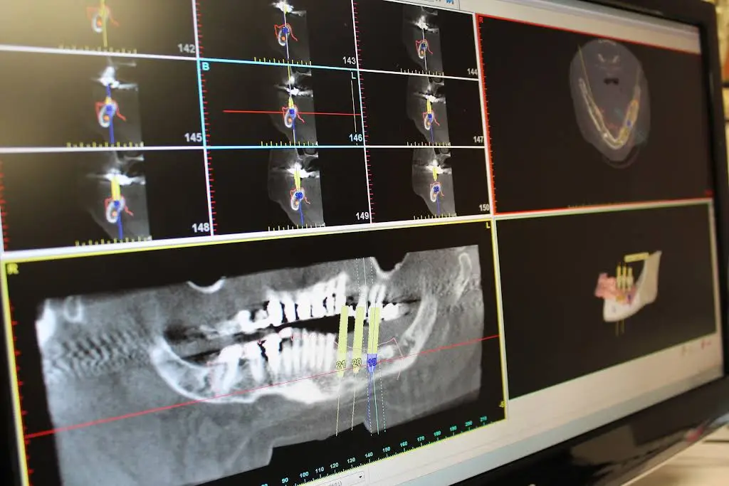 Periodontics and Dental Implants of Roswell
