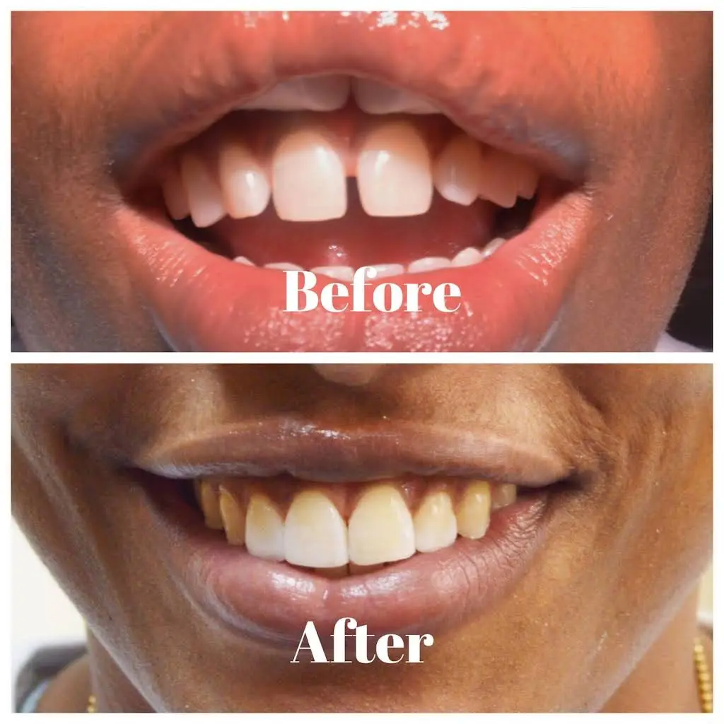 Winner Smile Dental