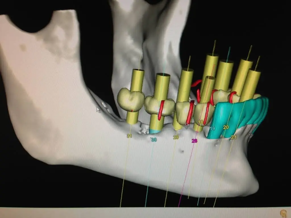 Atlanta Dental Restorative Specialists / ATLDRS