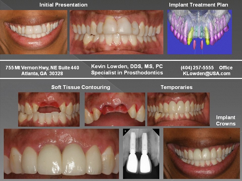 Atlanta Dental Restorative Specialists / ATLDRS