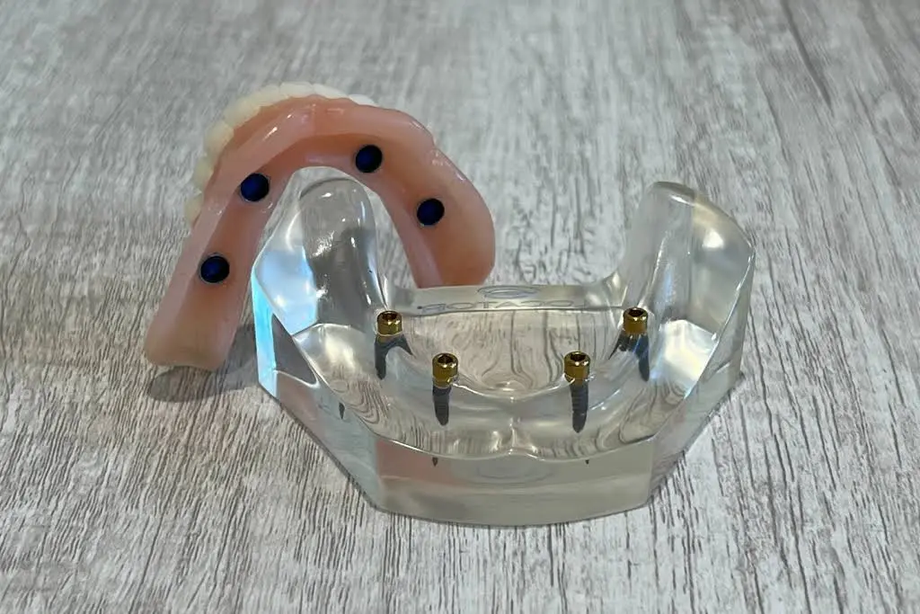 Peachtree Dentures and Implants