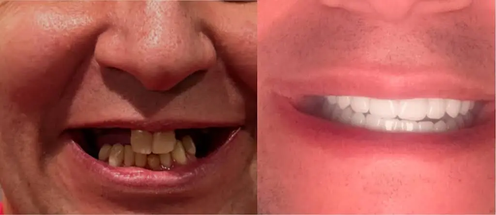 ClearChoice Dental Implant Center
