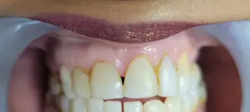 Perfect Image Dental Associates