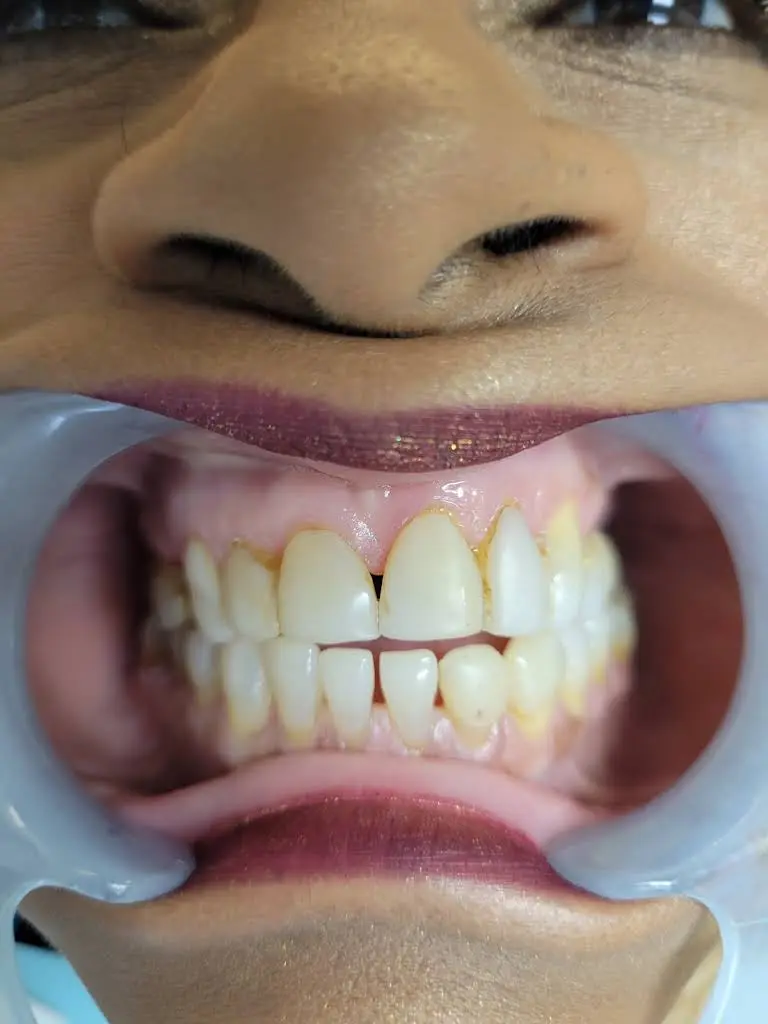 Perfect Image Dental Associates