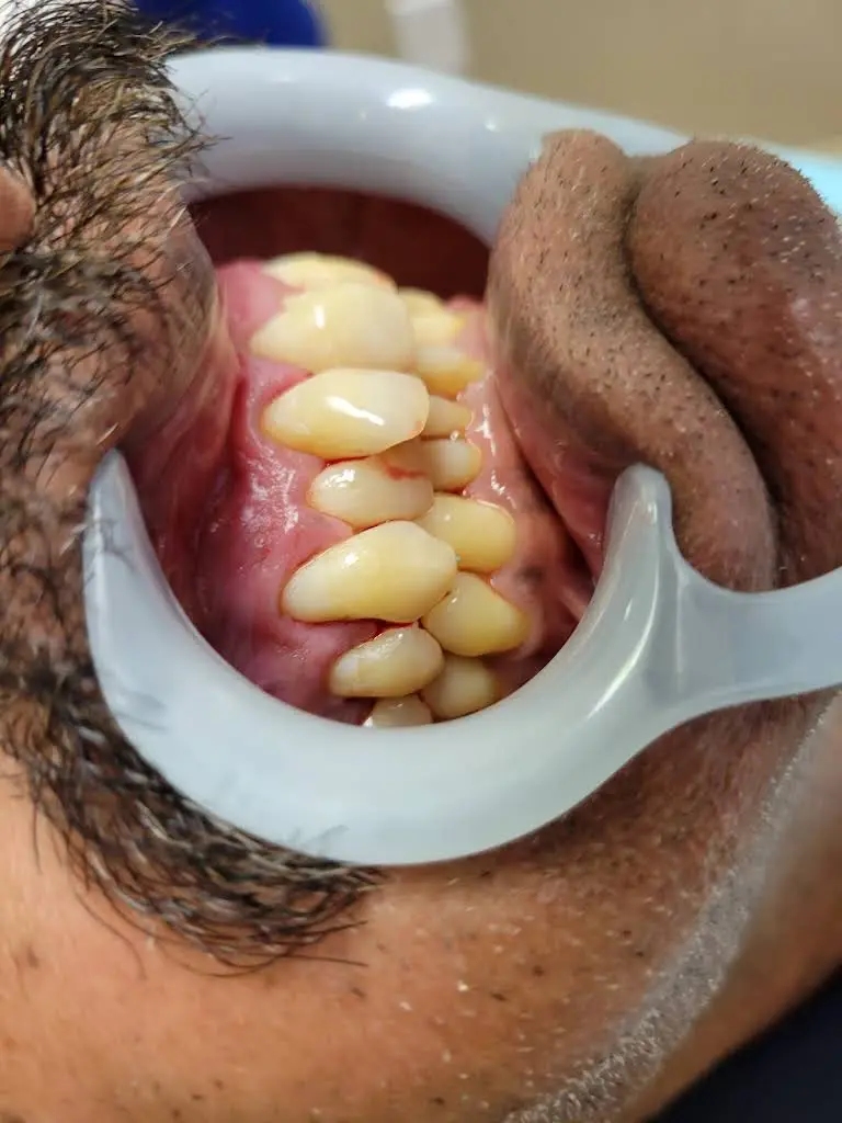 Perfect Image Dental Associates