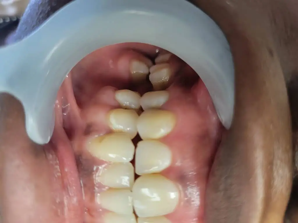 Perfect Image Dental Associates