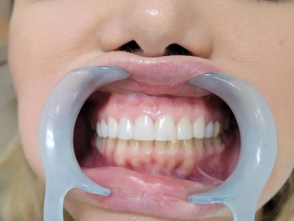 Perfect Image Dental Associates