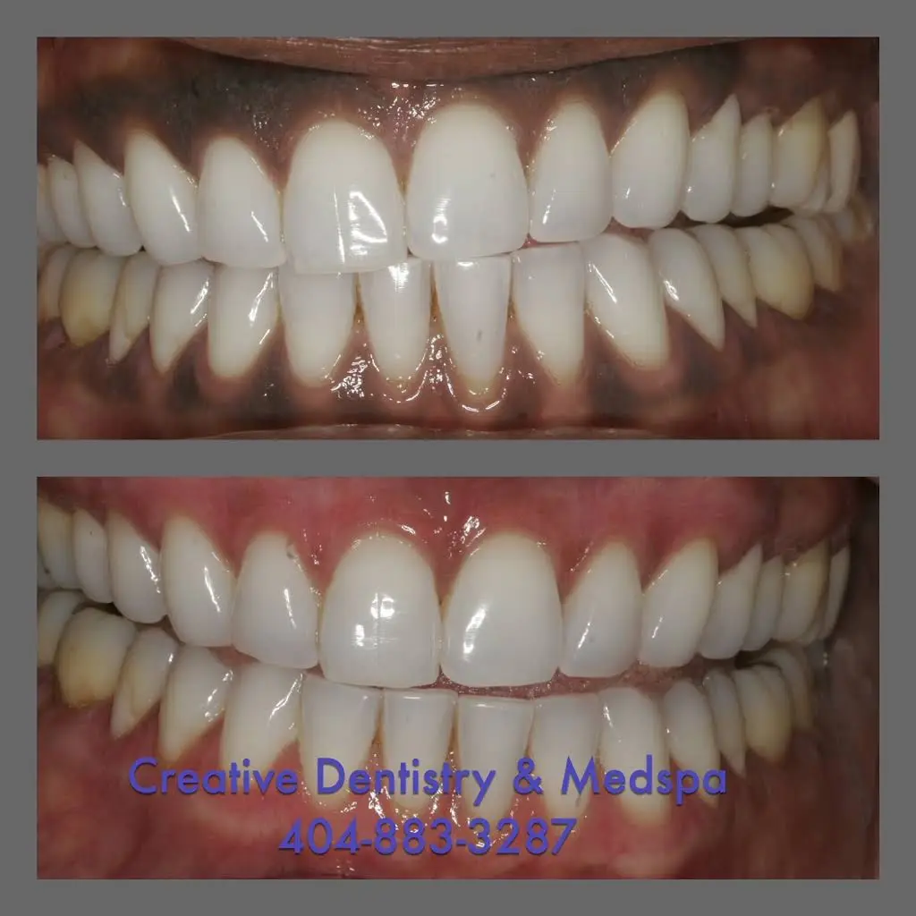 Creative Dentistry & Medspa