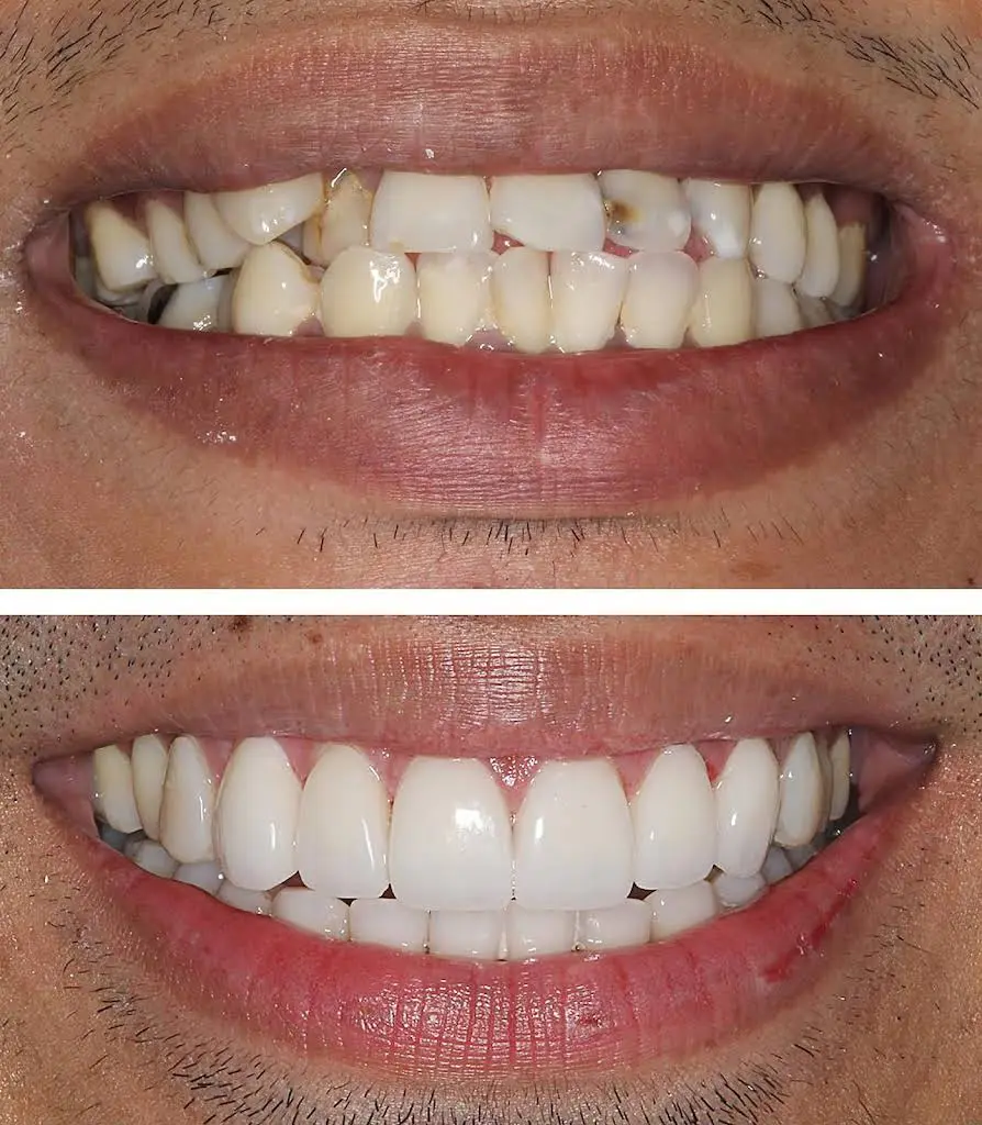 Gentle Smiles Dentist