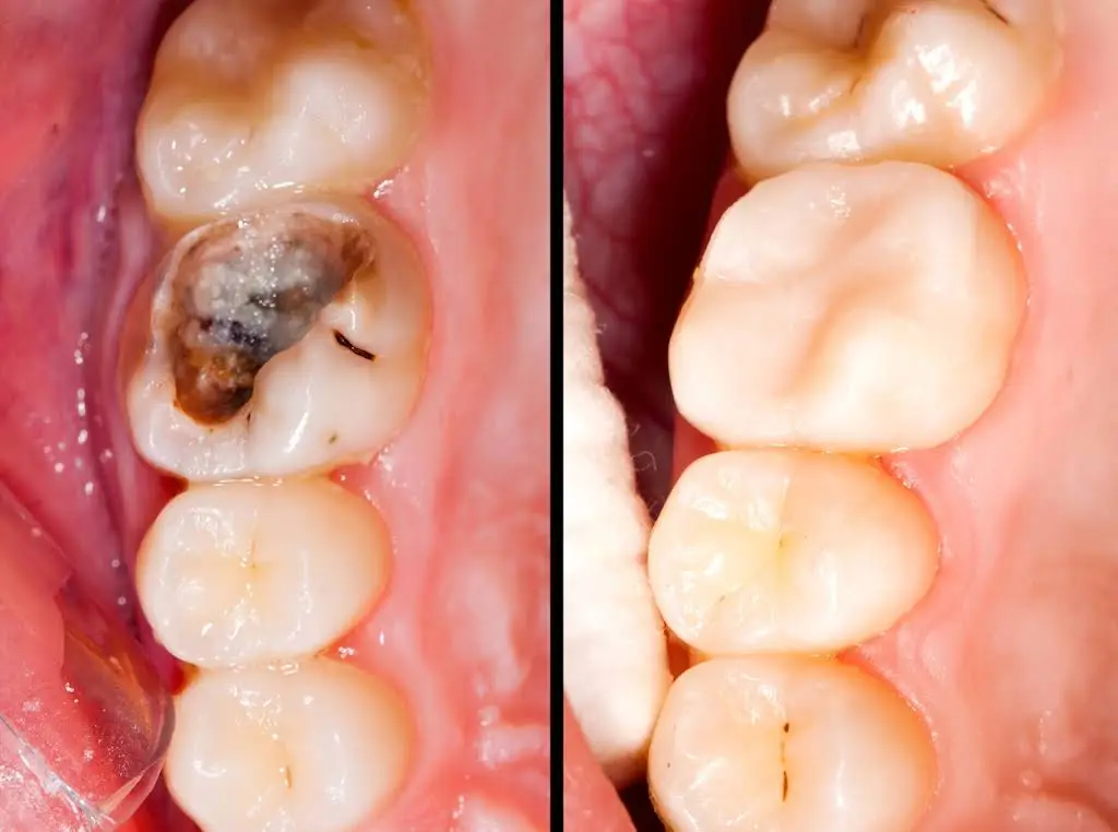 Gentle Smiles Dentist