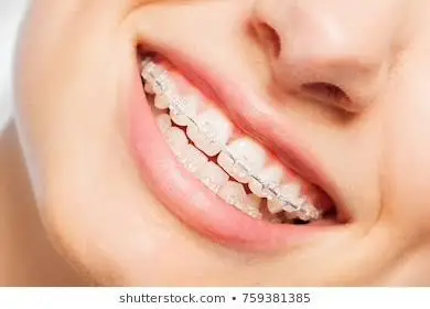 Gentle Smiles Dentist