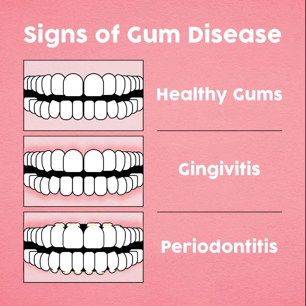 Cumming Dental Smiles