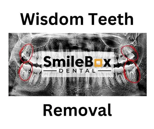 SmileBox Dental of Cumming