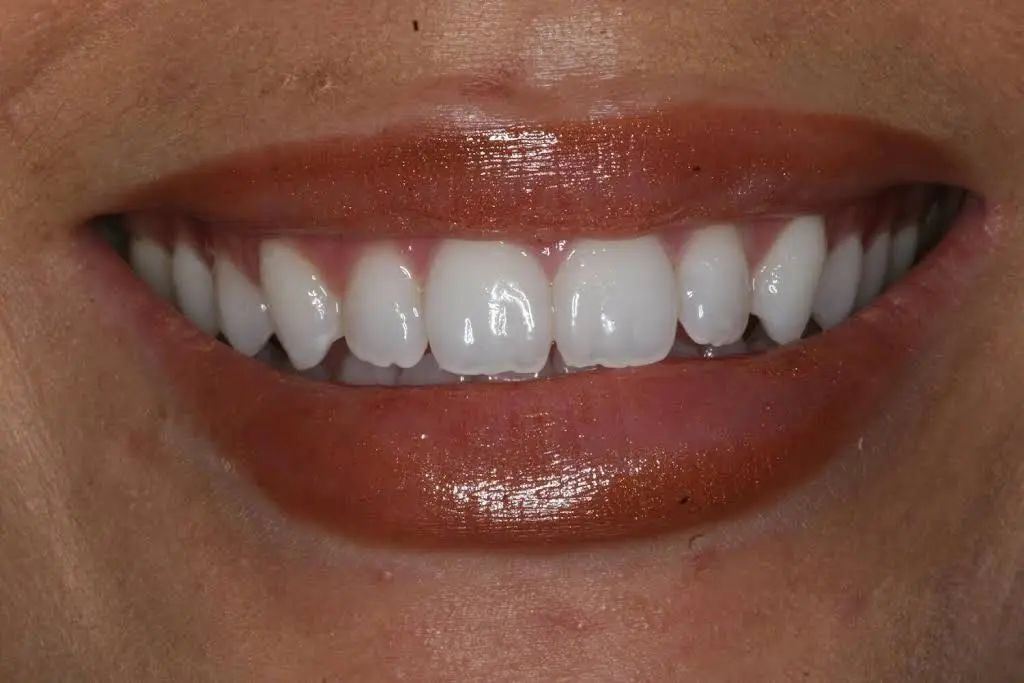 Atlanta Dental Spa