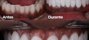 FRESH DENTAL ATLANTA