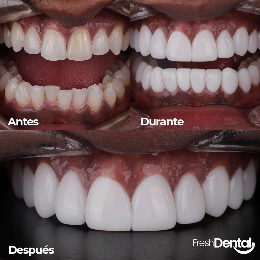 FRESH DENTAL ATLANTA