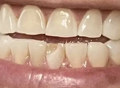 FRESH DENTAL ATLANTA