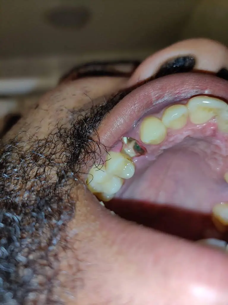 Aspen Dental